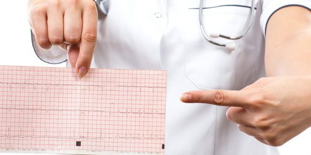 au-fost-publicate-anunturile-pentru-achizitii-in-cadrul-proiectului-cardioscope-690×304